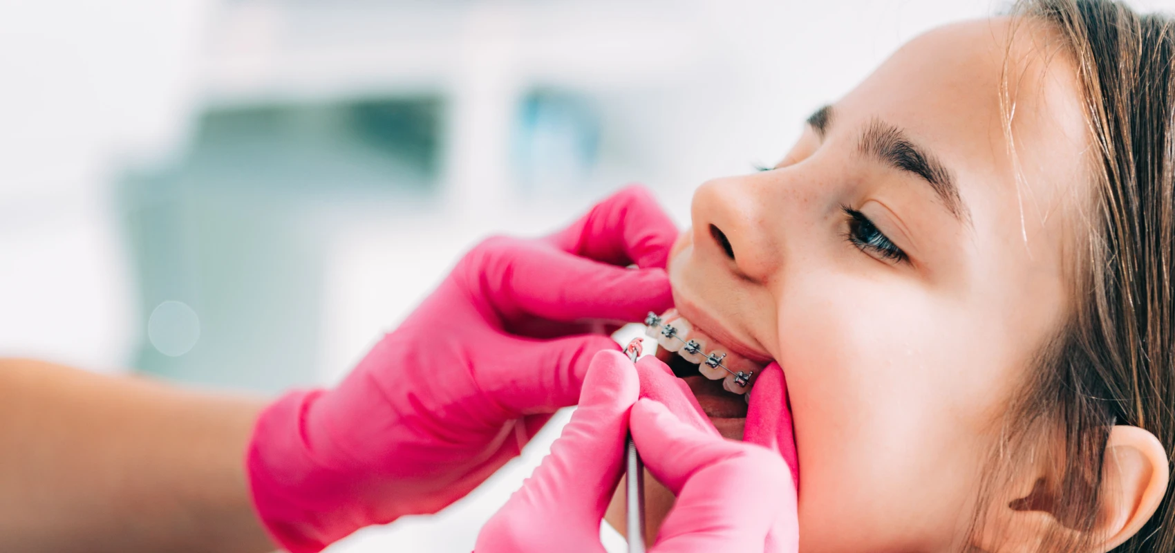 orthodontie adolescent multi attaches geneve