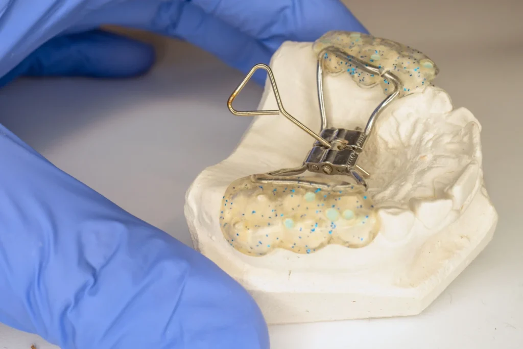 orthodontie appareil expansion palatine Douvaine