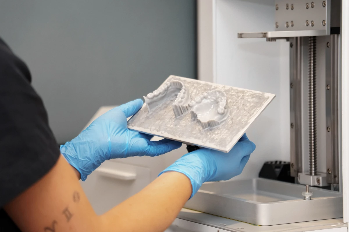 orthodontie douvaine geneve imprimante 3d